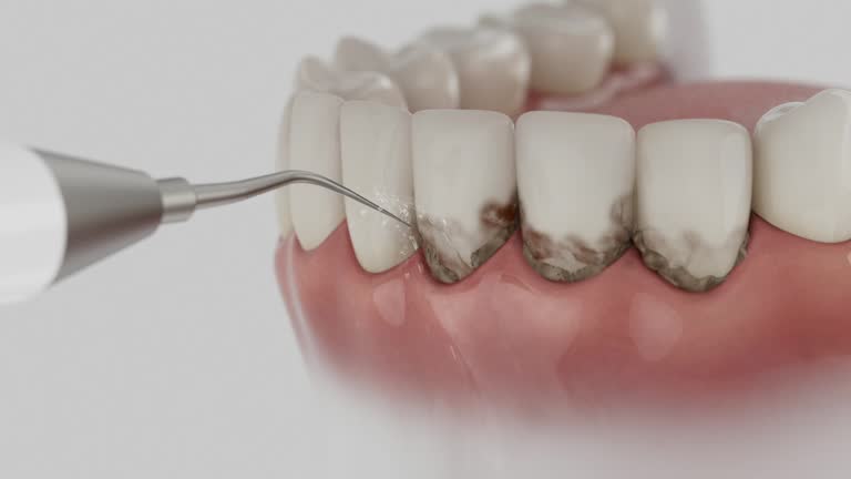 Reliable Dental contractor in Grissom AFB, IN by Dentist Open Now